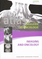 Atlas d'imagerie et oncologie - Christophe CHELLE - EDITOO - 