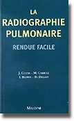La radiographie pulmonaire rendue facile - J.CORNE, M.CARROLL, I.BROWN, D.DELANY - MALOINE - 