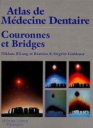 Couronnes et bridges - Niklaus P.LANG, Batrice E.SIEGRIST GULDENER