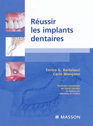 Russir les implants dentaires - Enrico G.BARTOLUCCI, Carlo MANGANO - MASSON - 
