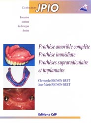 Prothse amovible complte Prothse immdiate Prothses supraradiculaire et implantaire - Christophe et Jean-Marie RIGNON-BRET