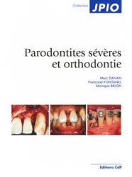 Parodonties svres et orthodontie - Marc DANAN, Franoise FONTANEL, Monique BRION - CDP - JPIO