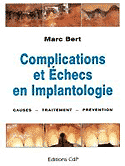 Complications et checs en implantologie - M.BERT