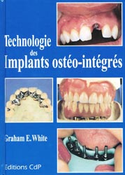 Technologie des implants osto-intgrs - GE.WHITE