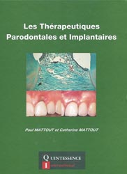 Les thrapeutiques parodontales et implantaires - P.MATTOUT, C.MATTOUT - QUINTESSENCE INTERNATIONAL - 