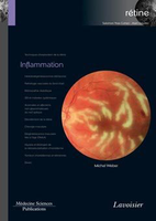 Inflammation - Michel  WEBER - LAVOISIER MSP - 
