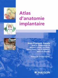 Atlas d'anatomie implantaire - Jean-Franois GAUDY - MASSON - 