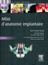 Atlas d'anatomie implantaire - Jean-Franois GAUDY, Bernard CANNAS, Luc GILLOT, Thierry GORCE