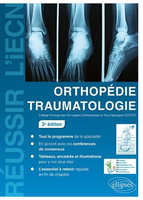 Orthopdie Traumatologie - 2e dition - Collge Franais des Chirurgiens Orthopdistes et Traumatologues - ELLIPSES - 