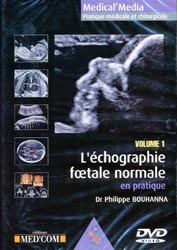 L'chographie foetale normale en pratique  Vol 1 - Dr Philippe BOUHANNA - MED'COM - Medical'Media  Pratique mdicale et chirurgicale