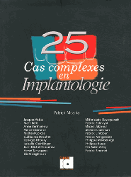 25 Cas complexes en Implantologie - Patrick MISSIKA, Collectif - ESPACE ID - 