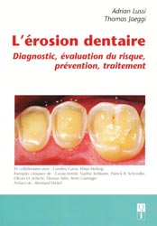 L'rosion dentaire - Adrian LUSSI, Thomas JEAGGI - QUINTESSENCE INTERNATIONAL - 