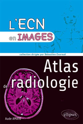 Atlas de radiologie - Aude AMATO - ELLIPSES - L'ECN en images