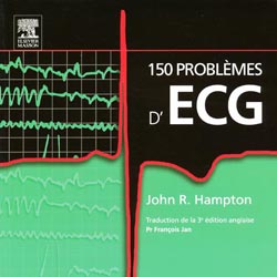 150 problmes d'ECG - Jhon R. HAMPTON - ELSEVIER - 