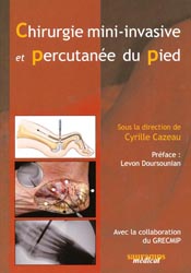Chirurgie mini-invasive et Percutane du Pied - Cyrille CAZEAU, collaboration du GRECMIP - SAURAMPS MEDICAL - 