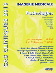 Cas clinique 2010 Imagerie Mdicale Pathologies - L. ARRIV, J.M. TUBIANA, Y. MENU - SAURAMPS MEDICAL - 