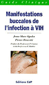 Manifestations buccales de l'infection  VIH - JM.OPOKA, P.BRAVETTI - CDP - Guide clinique
