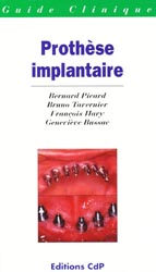 Prothse implantaire - B.PICARD, B.TAVERNIER, F.HARY, G.BUSSAC