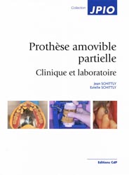 Prothse amovible partielle Clinique et laboratoire - Jean SCHITTLY, Estelle SCHITTLY