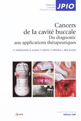 Cancers de la cavit buccale - H.TARRAGANO, B.ILLOUZ, F.MOYAL, P.MISSIKA, L.BEN SLAMA