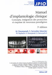 Manuel d'implantologie clinique - M.DAVARPANAH, S.SZMUKLER-MONCLER, Ph. RAJZBAUM, K.DAVARPANAH, G. DEMURASHVILI, Collectif - EDITIONS CDP - JPIO