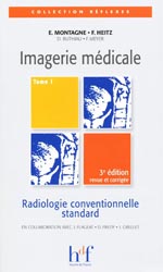 Imagerie mdicale Tome 1 - E. MONTAGNE, F. HEITZ, D. BUTHIAU, F.MEYER - HEURES DE FRANCE - Rflexes