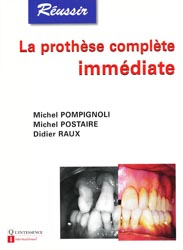 La prothse complte immdiate - M.POMPIGNOLI, M.POSTAIRE, D.RAUX