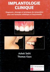 Implantologie clinique - Ashok SETHI, Thomas KAUS - QUINTESSENCE INTERNATIONAL - 