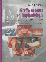 Greffe osseuse en implantologie - Fouad KHOURY - QUINTESSENCE INTERNATIONAL - 