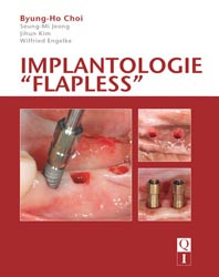 Implantologie flapless - Choi BYUNG-HO, Jeong SEUNG-MI - QUINTESSENCE INTERNATIONAL - 