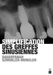 Simplification des greffes sinusiennes - M.DAVARPANAH, S.SZMUKLER-MONCLER