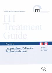 ITI Treatment Guide Vol 5 - H.KATSUYAMA, S.S.JENSEN